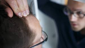 Der wachstumsphase, der übergangszeit und der ruhephase. Prp Therapie Nach Haarausfall Zdfmediathek