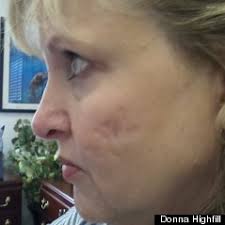 Beauty And Biblical Plagues