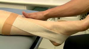 Image result for Taping for Soleus and Achilles