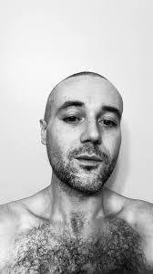 Anybody need to cast a baldy???