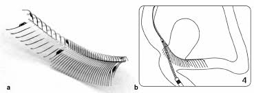 Eclips and ecal users has 1,658 members. Eclips Evasc Medical Systems Intended For Flow Diver Sion And Download Scientific Diagram