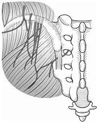 The cluneal nerve (referred to as clinoril nerve in some older texts) splits into three divisions to cross over the iliac crest. Entrapment Of Middle Cluneal Nerves As An Unknown Cause Of Low Back Pain