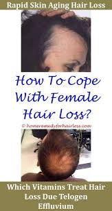 If the scalp doesn't breathe, it can constrict the hair follicles, causing them to disappear and thus resulting in hair loss. Diabetes Hair Loss On Legs