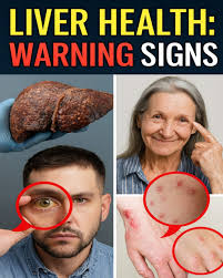 Signs of liver damage to watch out for