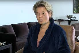 Veja abaixo os resultados dos tratamentos dentários antes e depois realizados pela equipa de dentistas da clínica mint lisboa. Misterio Em Brasilia Quem Agrediu A Deputada