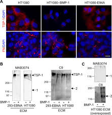 Is located in accra, ghana. Bmp 1 Disrupts Cell Adhesion And Enhances Tgf B Activation Through Cleavage Of The Matricellular Protein Thrombospondin 1 Science Signaling