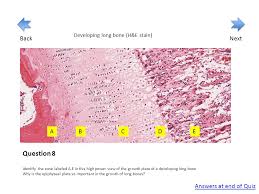 The membrane lining the bone cavity. Basic Histology Quiz Cartilage And Bone Created By Maureen Bain Start Ppt Download