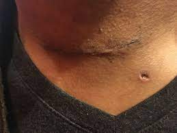 Pin On Post Operation