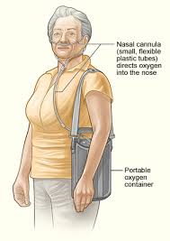 However, they advised against its use. How To Make Supplemental Oxygen More Comfortable