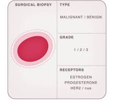 Others can be found in several types of cancers. Lab Tests National Breast Cancer Foundation