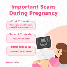 What do i need to know? Theasianparent Here Are The Scans Which You Can Expect Facebook