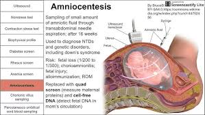 Image result for Fetal Testing Indications