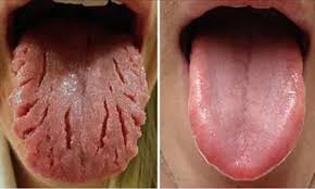 Did You Know That The Tongue Is Like A Barometer To Your Body S Health And Performance Your Tongue S Shape Tex Tongue Health Health And Nutrition Body Health