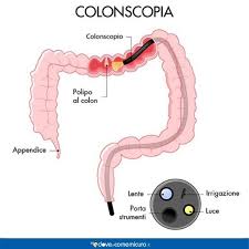 Assicurarsi dei buoni contenuti di vitamine ogni giorno significa. Colon Retto Funzioni Esami E Principali Patologie