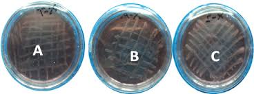 Agar (bgs) and brilliant green agar (bg) were found to be superior. Salmonella And Shigella Resistance To Tetracycline Grown In The Xld Download Scientific Diagram