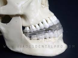 We did not find results for: Dispositivo De Avance Mandibular Clinica Dental Prodental Hiades
