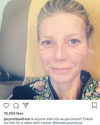 Body & Soul Acupuncture Clinic