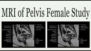 Postnatally, the human upright posture has also placed highly species specific physical demands on this structure. Mri Of Pelvis Female Study Youtube