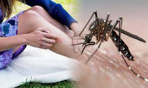 Prevention is key to minimizing your risk of an insect bite or sting. How To Stop A Mosquito Bite From Itching Apply A Cold Compress Or Ice Pack For Relief Express Co Uk