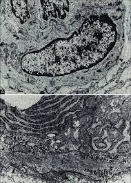 Anterior superior iliac spine insertion: Comparison Between Myoepithelial Cells And Smooth Muscle Cells A Download Scientific Diagram