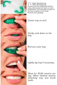 Jul 13, 2021 · if you want fast results, laser whitening and zoom whitening can whiten teeth by several shades in just one hour. How To Whiten Teeth With Braces At Home Fast Teethwalls