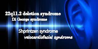 Prevalence And Nature Of Hearing Loss In 22q11 2 Deletion Syndrome Journal Of Speech Language And Hearing Research