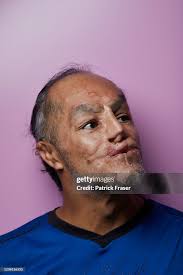 David Lopez Jackson. David was adopted by plastic surgeon Professor... News  Photo