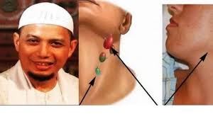 Limfoma atau kanker kelenjar getah bening adalah sejenis kanker. Ustaz Arifin Ilham Meninggal Karena Kanker Getah Bening Ini Makanan Yang Harus Dihindari Warta Kota