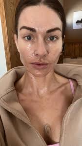 Come with me to get my quarterly RF Microneedling done @june.beauty.lab RF  (Radiofrequency) microneedling combines two powerful skin  treatments—microneedling and radiofrequency energy. 1.Collagen ...