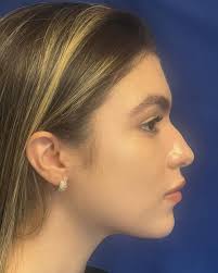 Dr. Mario Botero Ramirez 的Instagram photo • Apr 22, 2024 at 6:56 PM