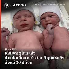 ได้ลืมตาดูโลกแล้ว! ฝาแฝดเกิดจากตัวอ่อนที่ถูกแช่แข็งตั้งแต่ 30 ปีก่อน