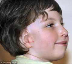Boy, 9, born with no ear is left delighted after surgeons rebuild it using  tissue from his ribcage