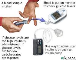 Dog Diabetes Symptoms Panting Diabetic Unit Insulin Chart