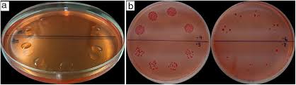 The drop plate method as an alternative for Azospirillum spp. viable cell  enumeration within the consensus protocol of the REDCAI network