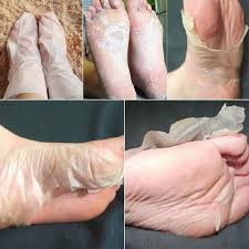 Baimiss 1 Bag 2 Pcs Peeling Exfoliating Foot Mask Feet Mask Remove Dead Skin Cuticles Heel Foot Care Pedicure Socks H Pele Morta Cuidados Com Os Pes Esfoliante