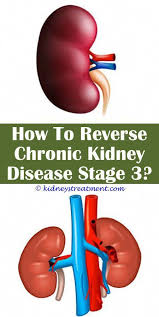 Chronic Kidney Disease Electrolyte Imbalances Is Kidney Stones A Disease Or Disorder Diseases That Affect Kidneys And Lungs How To Protect Your Pets Pinte