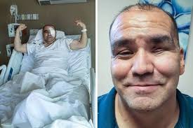 ¿cuáles son los síntomas del mortal 'hongo negro' que afecta a los recuperados del covid? Nfrdx7kswvidzm