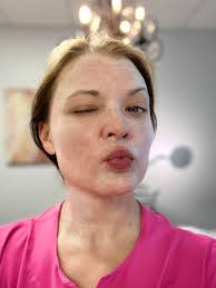 TotALLY Skin Esthetics