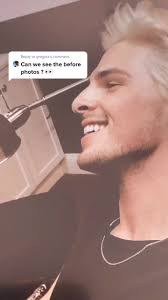 Reply to @gregpiz the before photos of my nose 👃🏼 #nosejobcheck  #beautytip #nosejob