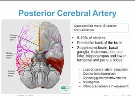 It's the vessel least commonly affected by strokes, so a stroke involving the aca can easily be misdiagnosed. Radiology Assistant Cva July 2021
