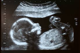 Shop plans for medicare, medical, dental, vision & employers. Faq Health Care And Pregnancy Wellmark Blue