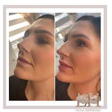 Lana Holmes Aesthetics