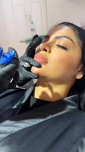 ¡Perfecto! Aquí tienes un copy para TikTok sobre la mentoplastia con ácido  hialurónico en el consultorio de la doctora K en Bogotá: --- ¿Buscas  mejorar el perfil de tu rostro sin cirugía? ✨ La Dra. K ...