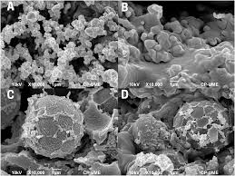 Image result for Metteniusaceae