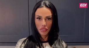 Katie Price sparks concern as she shows off new facelift: "Are you trying  to look like Pete Burns?" ⬇️