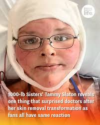 She's opened up about the intense surgery 😮