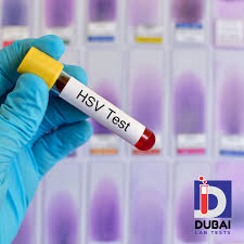 Image result for Herpes Simplex Virus Testing