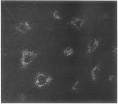 Human growth hormone stimulates proliferation of human retinal  microvascular endothelial cells in vitro.