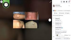 Jika diberikan kesempatan untuk hidup lebih panjang, ia pernah berjanji ingin bermanfaat untuk orang banyak. Cek Fakta Tidak Benar Kanker Getah Bening Bisa Sembuh Dengan Minum Air Rebusan Pepaya Muda Cek Fakta Liputan6 Com
