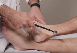 Image result for Low Back Standing Exam